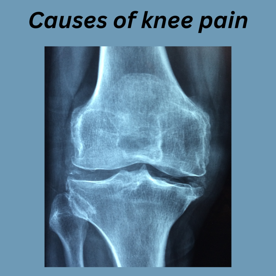 The Guide How To Deal With Knee Pain